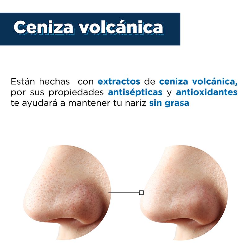 Bandas-Nasale-para-Puntos-Negros-en-Barro-Volcanico-para-Hombres-10-Pzas-4-21338